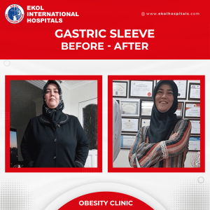 before-after-post-obesity-157_4824-8120